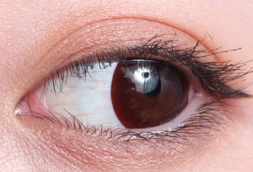 ナチュラルブラック 14.5mm片目着画